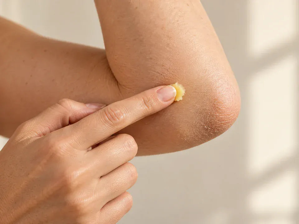Illustration, not a product photograph: a small amount of balm applied to an adult elbow